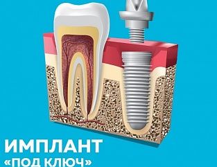 Фото: "Семейная стоматология"